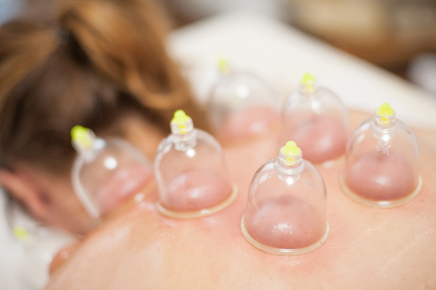 Schröpfen Schröpfmassage