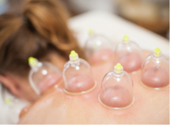 Schröpfen / Schröpfmassage